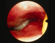 Desórdenes nasales3