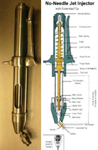 Anestesia