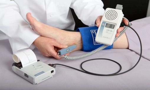 diagnostico angiologia