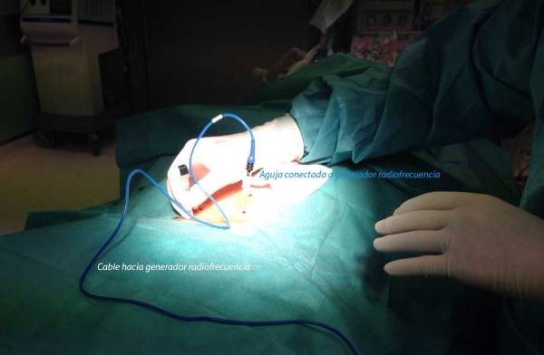 Procedimiento risolizis