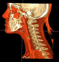 Planificación-3D-de-rinoplastia-(interior)