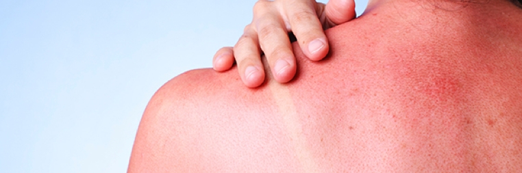 dermatologia oncologica dr lopez gil teknon