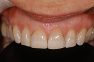 Después del proceso