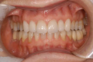 Después del proceso