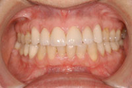 Después del proceso