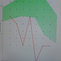 TEST-SENSIBILIDAD-CONTRASTE-PRUEBA-MEDICA-OFTALMOLOGIA-OFTALNOVA-BARCELONA-5-200x200