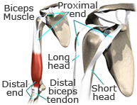 Rotura de bíceps braquial