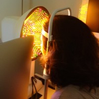 TOPOGRFIA-CORNEAL-CASSINI-Prueba-oftalmologia-Oftalnova-Barcelona