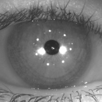 TOPOGRFIA-CORNEAL-CASSINI-Prueba-oftalmologia-Oftalnova-Barcelona