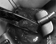 Selección de pulpa testicular