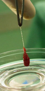 Muestra en el medio del cultivo