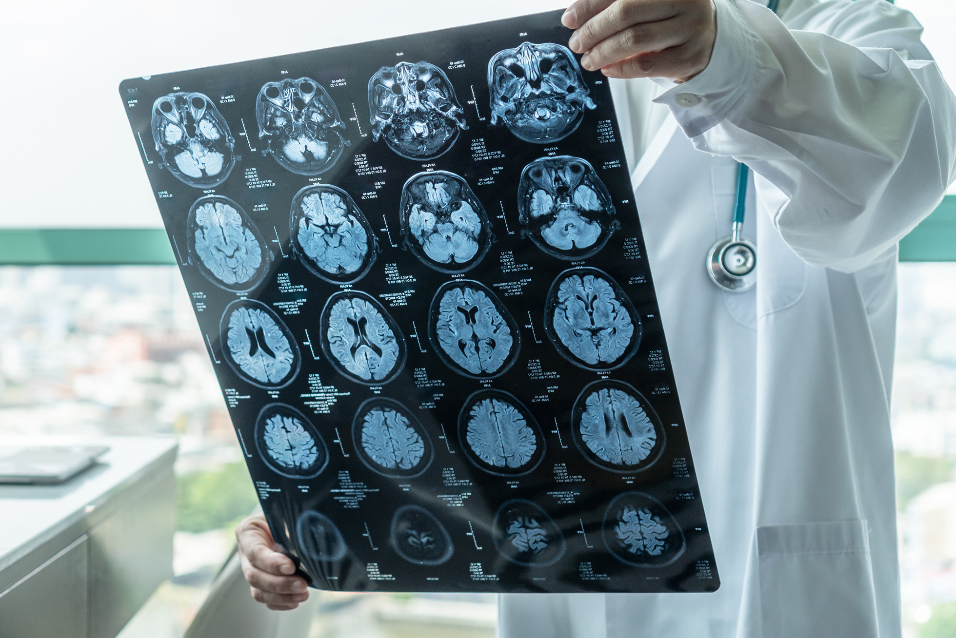 Instituto de Neurociencias Teknon - Cabecera móvil