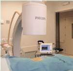 Denervacion radiofrecuencia