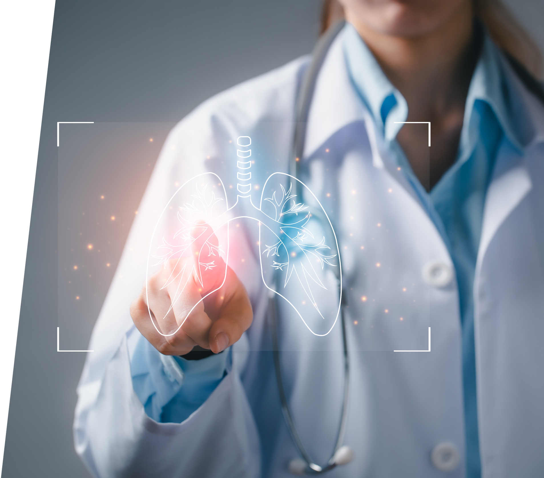 Unidad de Neumología Teknon - Cabecera