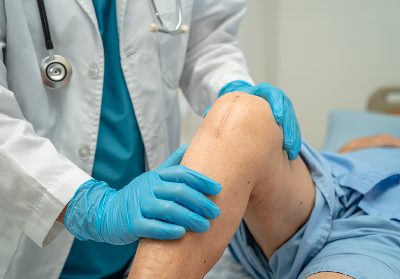 Prótesis de rodilla