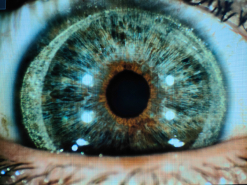 post quir derecho_Dr. Castanera_CM Teknon