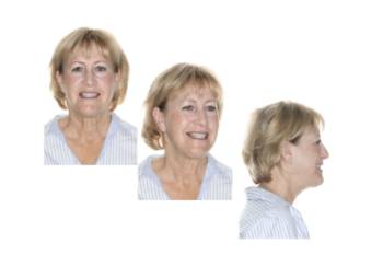 Apnea del Sueño Teknon