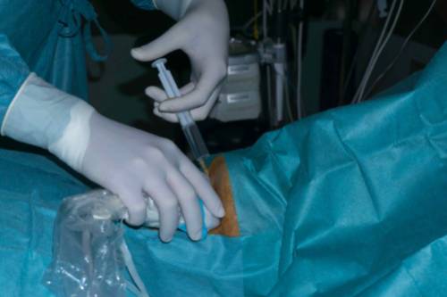 celulas madre Centro Medico Teknon