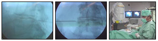 ozonoterapia-4