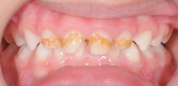 Odontopediatria 1