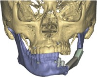 Software 3D