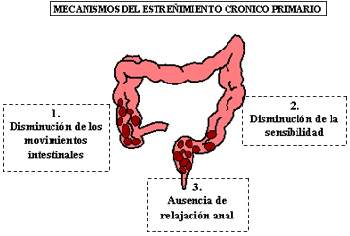 Estreñimiento