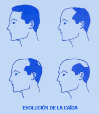 Evolución de la caída