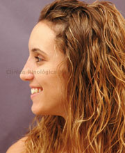 Cirurgia_estetica_testimoni_dona_despres