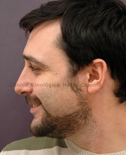 Cirurgia_estetica_testimoni_home_despres