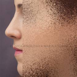 Resultats_perfil_post