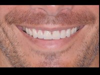 Diapositiva2