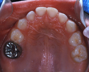Odontopediatria 5