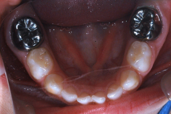 Odontopediatria 6
