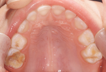 Odontopediatria 4