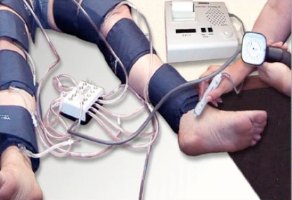 indice tobillo brazo diagnostico de la EAP