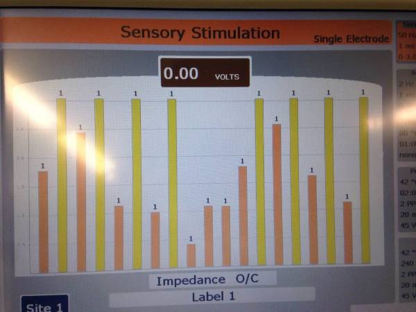 Procedimiento risolizis