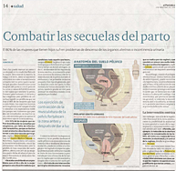 Combatir las secuelas del parto