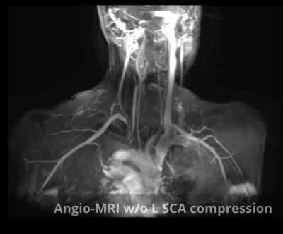 angio mri