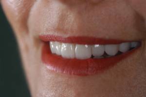 despues dientes y labios rojos