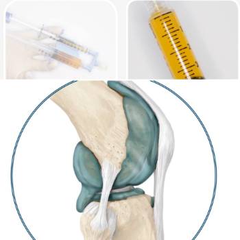medicina regenerativa