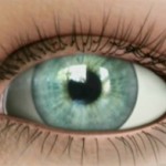 Oftalnova_Oftalmologos_Barcelona_Cataratas_ojo_normal-150x150