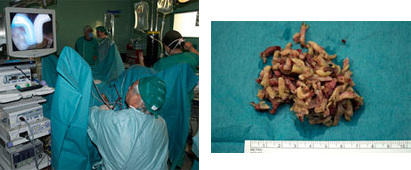 tecnicas quirurgicas_3