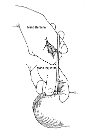 Separación del deferente.