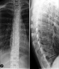 RX Columna dorsal