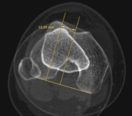 TC Estudio rotacional EEII