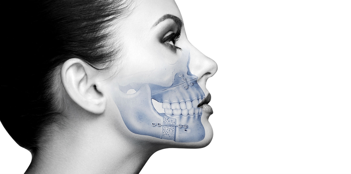 Instituto Maxilofacial