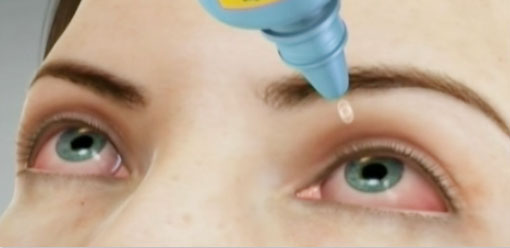 Oftalnova_oftalmologia_Barcelona_Tratamiento_del_ojo_seco