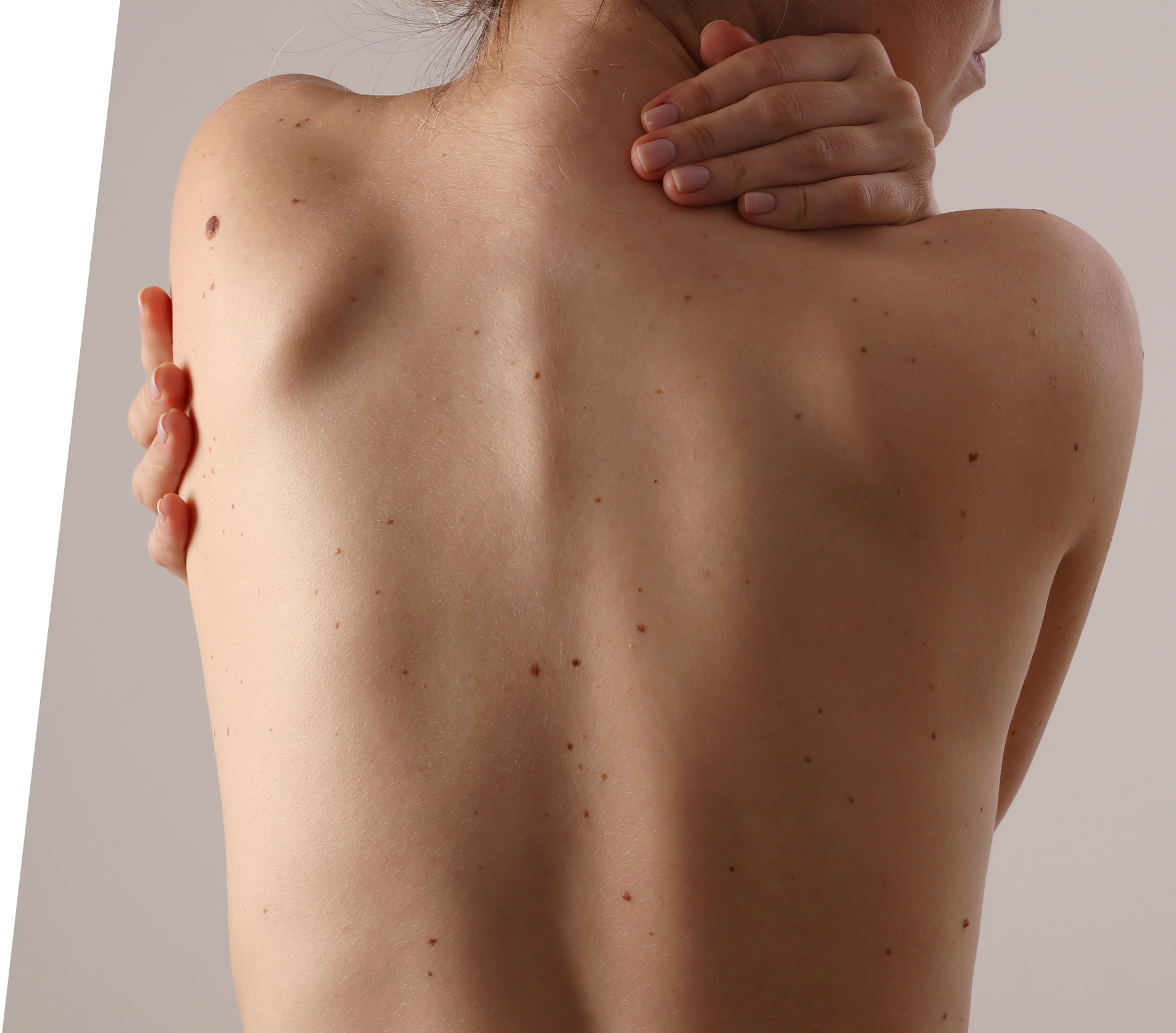 Unidad de Dermatología - Cabecera