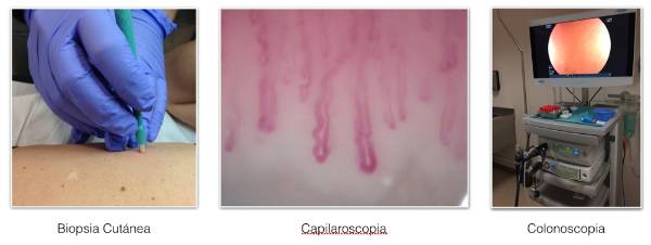 pruebas diagnósticas enfermedades inflamatorias y autoinmunes sistémicas