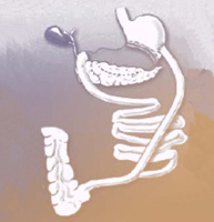 Técnica que impide la absorción de los alimentos